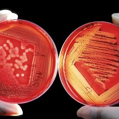 Petri dishes