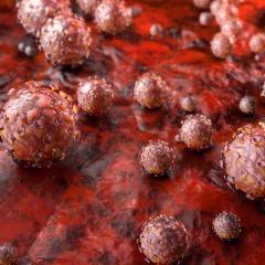 UQCCR research informs international guidelines on Sepsis management