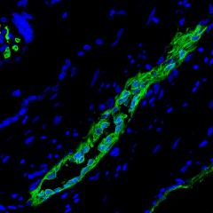 Researchers have found a new type of stem cell