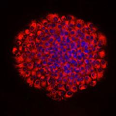 Breakthrough research discovery to help heal chronic wounds