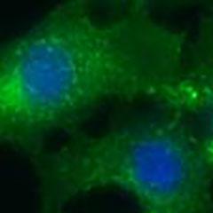 stem cells